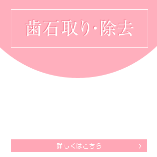 歯石取り・除去