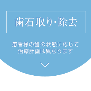 歯石取り・除去